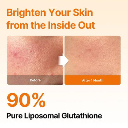 Liposomal Glutathione Direct – 30 Streifen